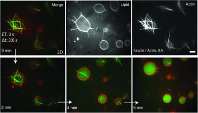 Confinement Geometry Tunes Fascin-Actin Bundle Structures and Consequently the Shape of a Lipid Bilayer Vesicle